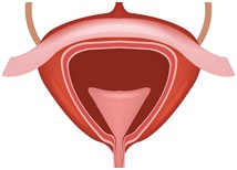 cystosco